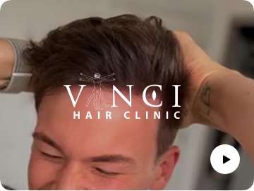 Optimising Google Ads to Solve the World’s Bad Hair Days